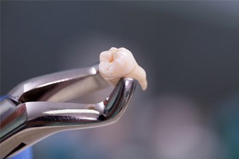 Tooth in a pair of forceps